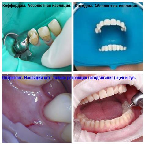 индикаторы качества стоматологического лечения